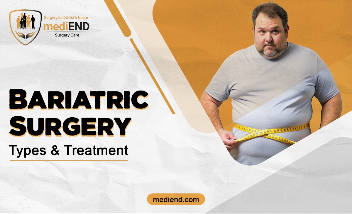 Bariatric Surgery Types & Treatment45