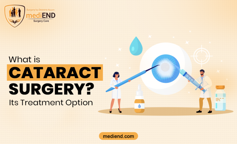 What is Cataract Surgery? Its Treatment Option