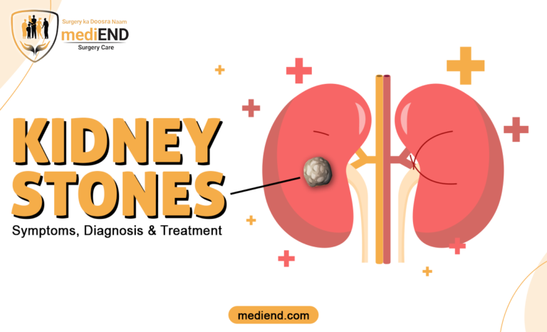 Kidney Stones Symptoms, Diagnosis & Treatment