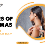 Types of lipomas and how to treat them