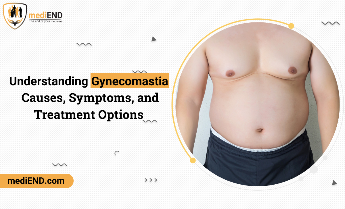 Gynecomastia surgery: Causes, Symptoms, and Treatment Options