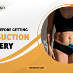 8 Things to Know Before Getting Liposuction Surgery