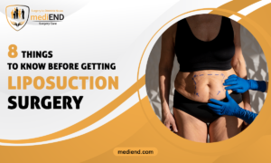 8 Things to Know Before Getting Liposuction Surgery