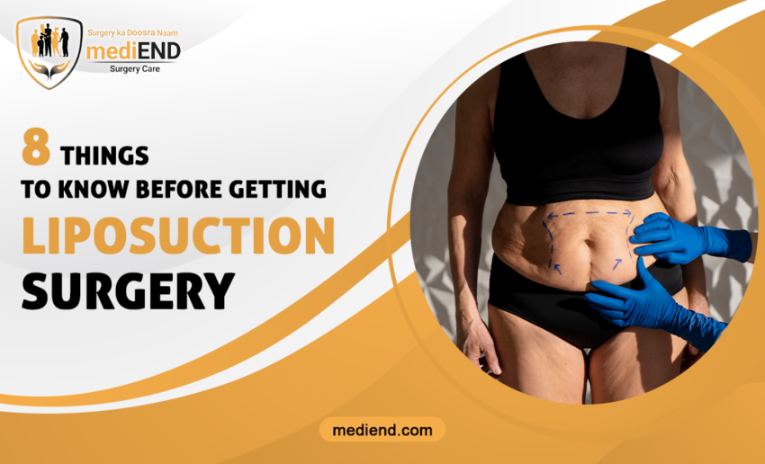 8 Things to Know Before Getting Liposuction Surgery