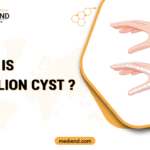 What is Ganglion Cyst?